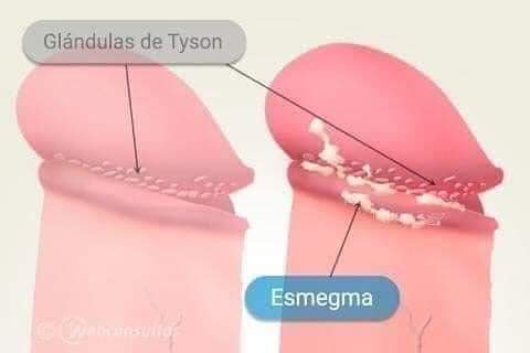 ¿Qué es el Esmegma?